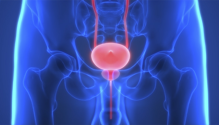 Novembro Azul: hiperplasia prostática benigna - o que devemos saber sobre essa condição?