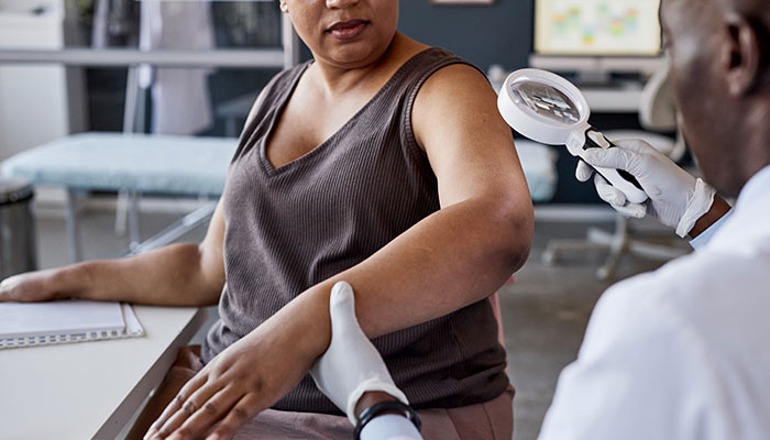 Prevenção ao câncer de pele: como se proteger, reconhecer os sinais e entender os novos tratamentos