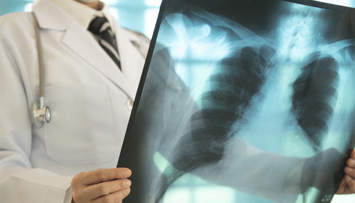 Hospital do Servidor conta com inteligência artificial para agilizar análise de raio-X